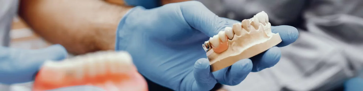 Technik dentystyczny prezentujący model z koroną protetyczną